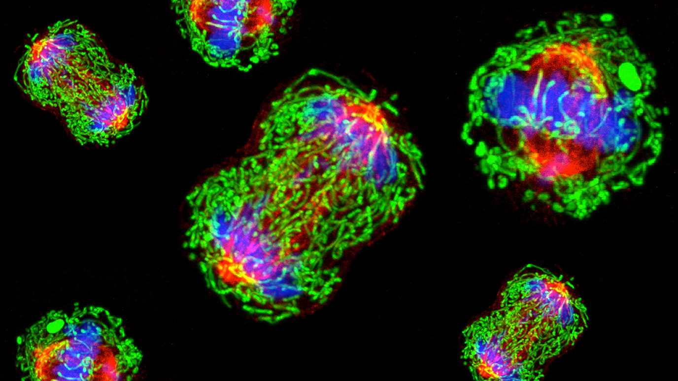 细胞分裂期间中期中的三阴性乳腺癌细胞