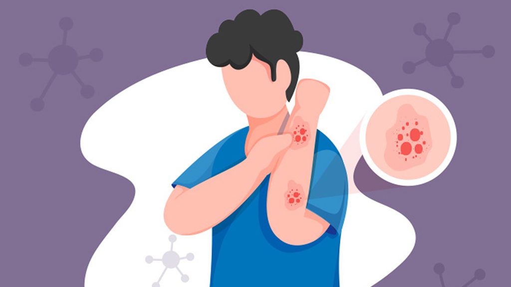 插图与紫色背景和人在手腕抓红疹