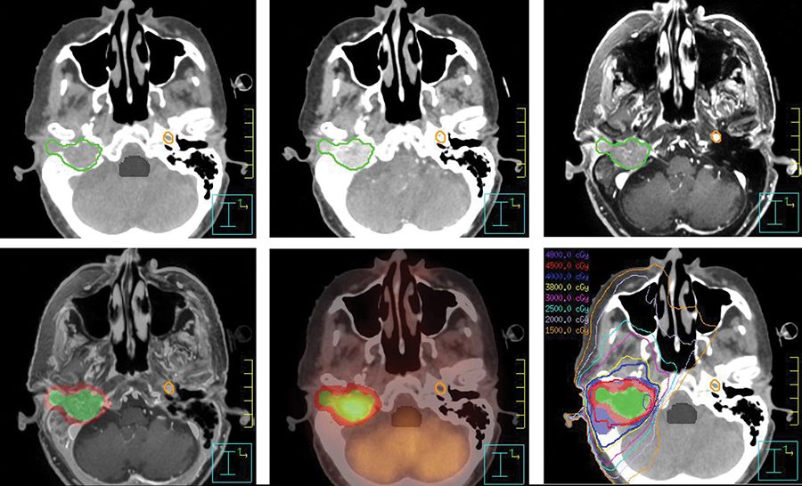 CT, MRI, PET-CT扫描