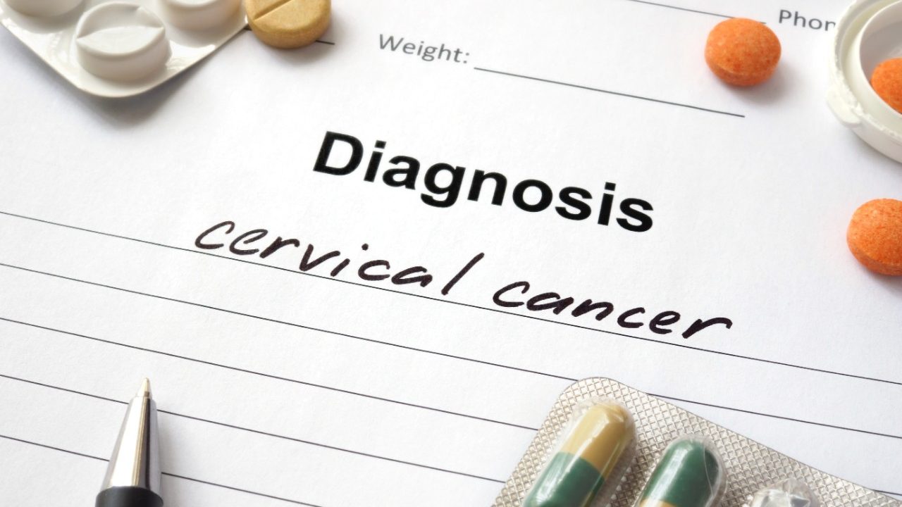 关于癌症的博客文章:了解子宫颈癌的神话