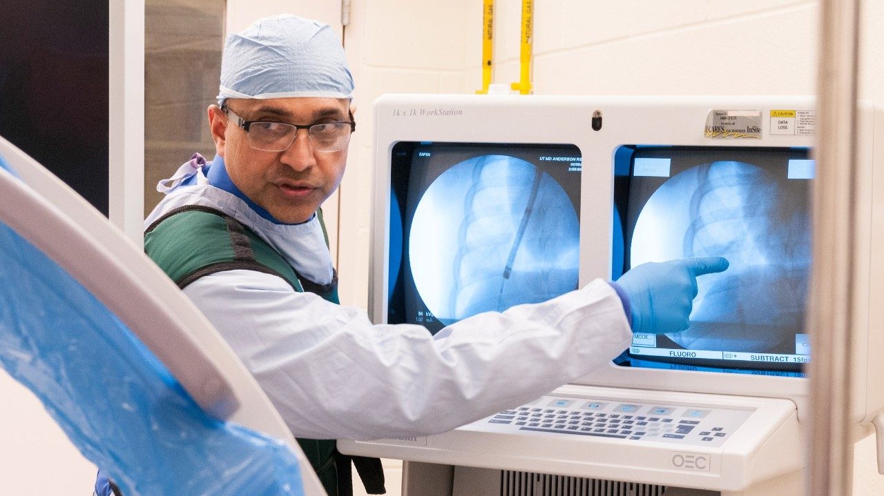 肺病学乔治·伊阿厄潘，M.D.检查了患有癌症治疗的患者的肺部