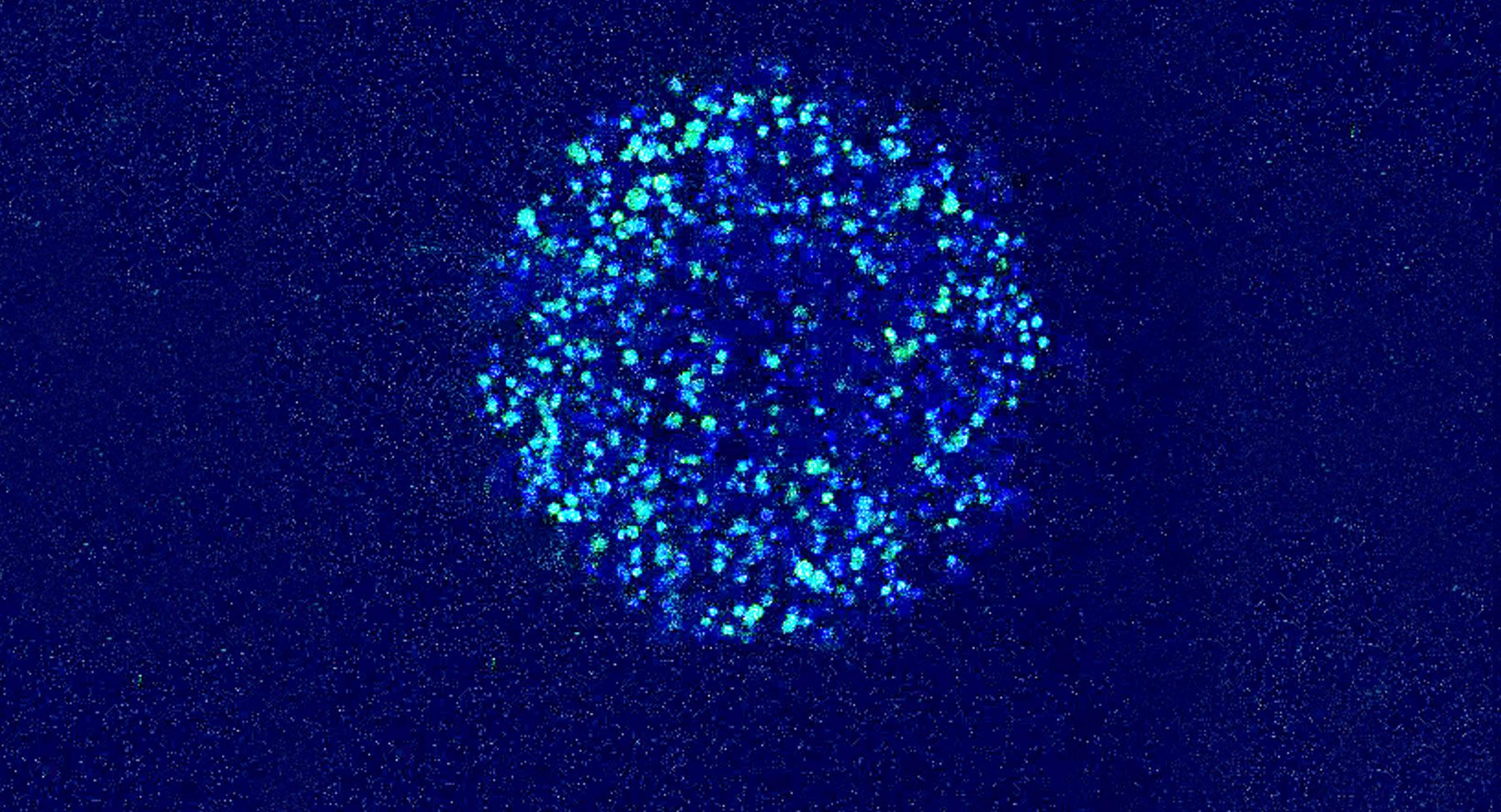 包裹在海藻酸盐床中的肿瘤细胞的显微图像，用于将MRS同时在数百个活细胞中评价高孔化的C-13丙酮酸至C-13。