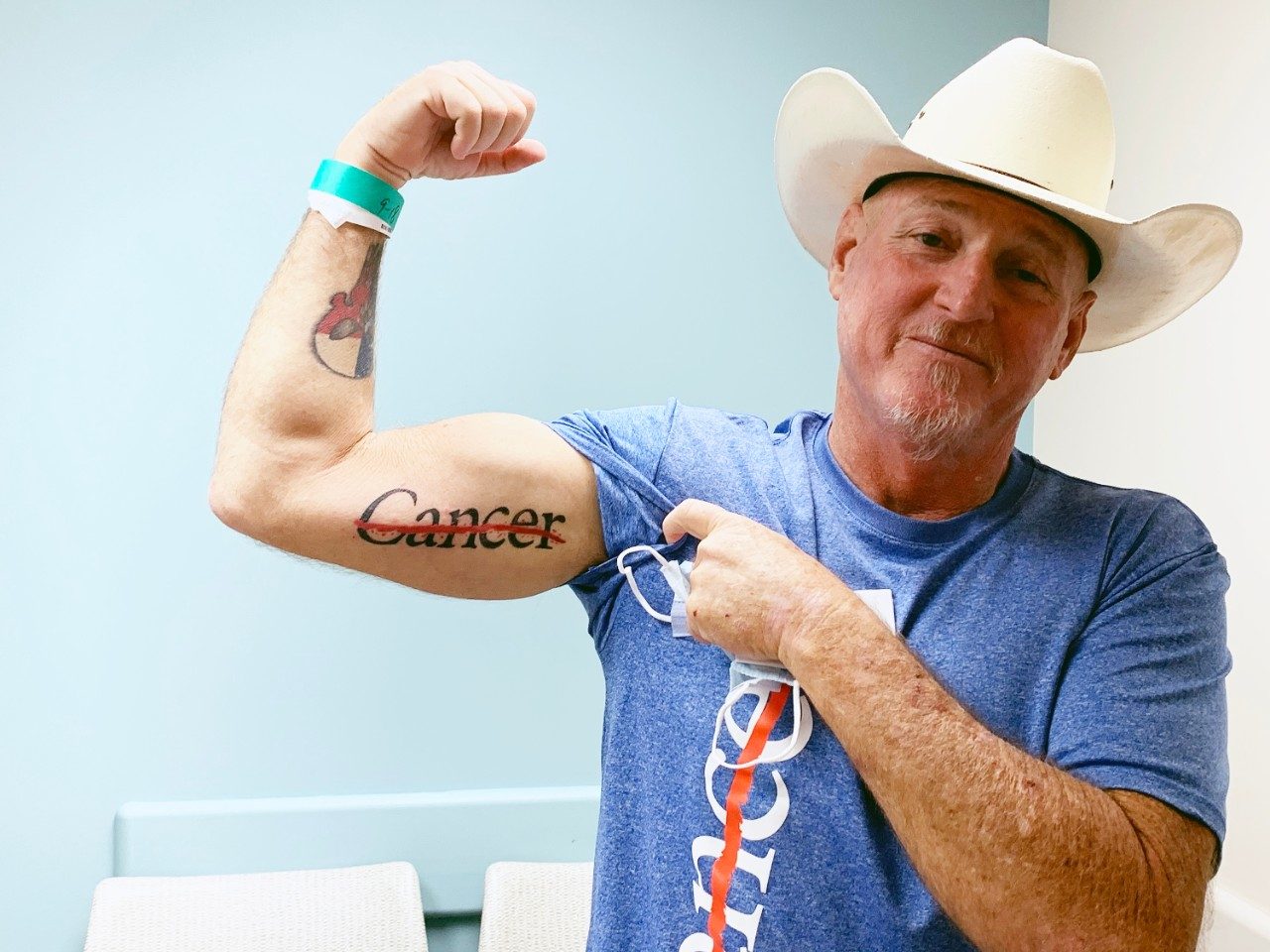 扁桃体癌症幸存者提姆·哈德斯蒂弯曲手臂展示他的癌症条纹纹身
