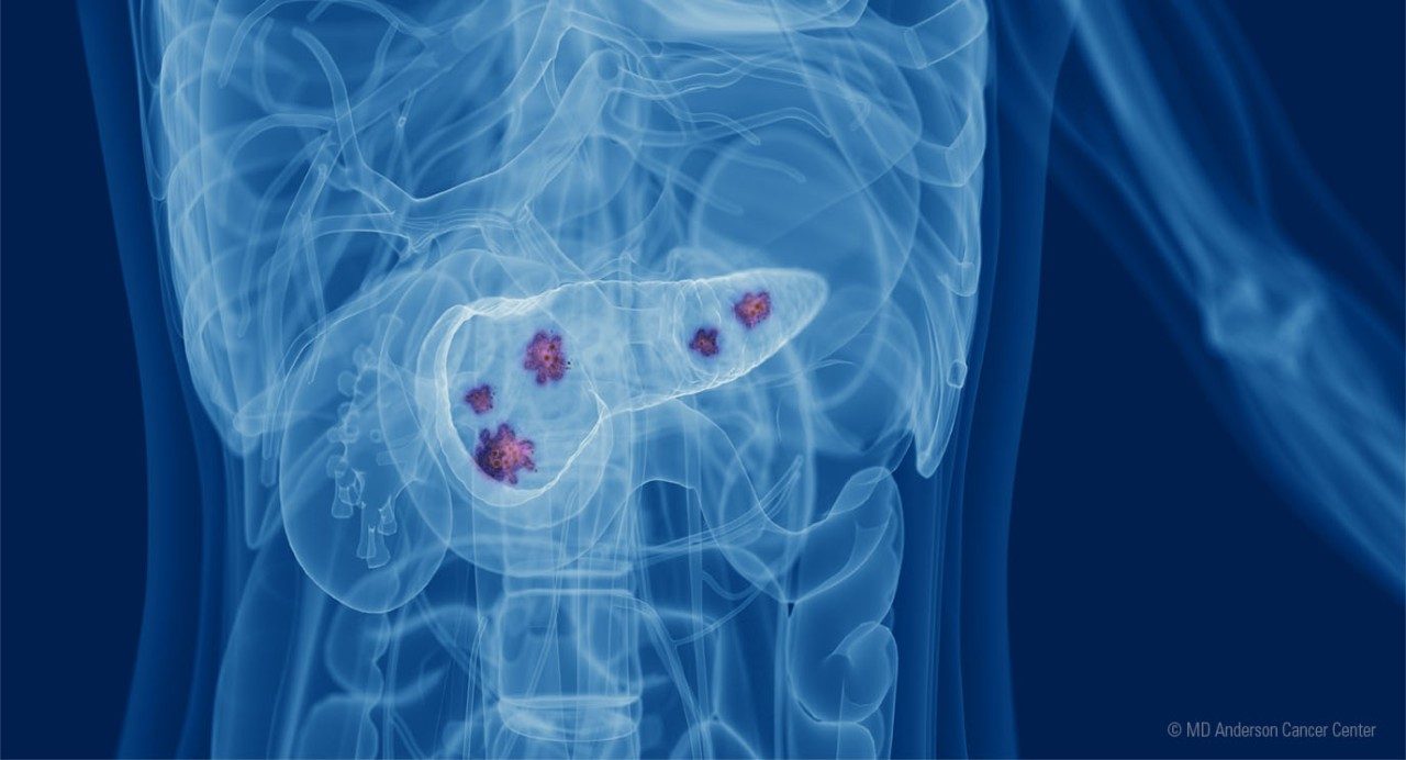 患病的胰腺X-射线视图的例证由jordan pietz的