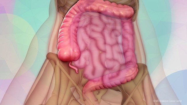 医学插图显示肠道和阑尾