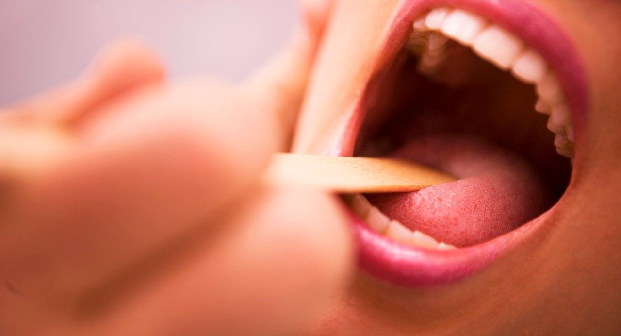 Photo of open mouth with tongue depressor
