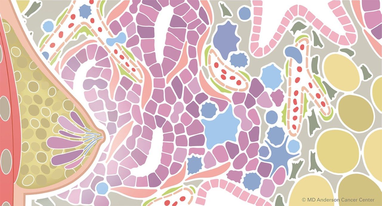 彩色插图的乳房小叶的肿瘤微环境的描述