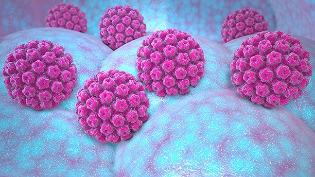 浅粉红HPV病毒医学插图