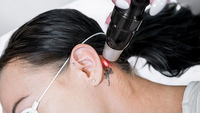 戴防护眼罩的妇女耳后有玫瑰纹身摘除