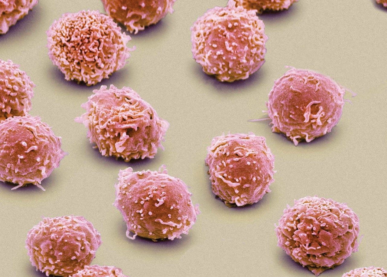 从扫描电子显微照片示出了白血细胞，其包括淋巴细胞如T细胞和自然杀伤（NK）细胞的图像。