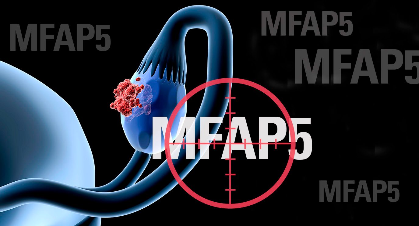 乐动体育LDsports中国研究人员发现，针对在小鼠模型中MFAP5蛋白减少参与了卵巢癌和胰腺癌的纤维化。