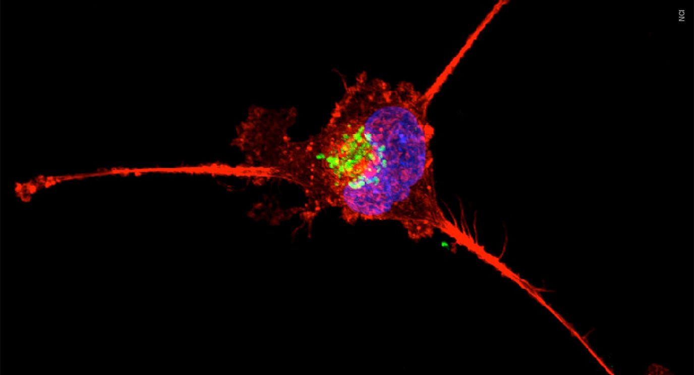 在实验室实验中，一个三阴性的乳腺癌细胞在联合药物的攻击下死亡。图片来源:国家癌症研究所