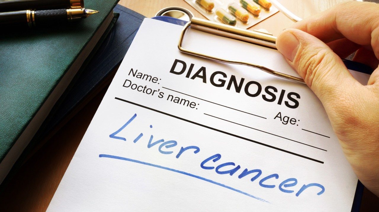 “肝癌”写在纸上的诊断