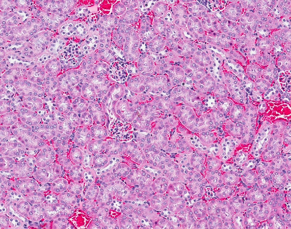 苏木精和曙红（H＆E）染色的肾细胞