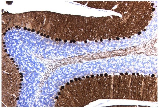 钙结合蛋白-d染色的小脑节