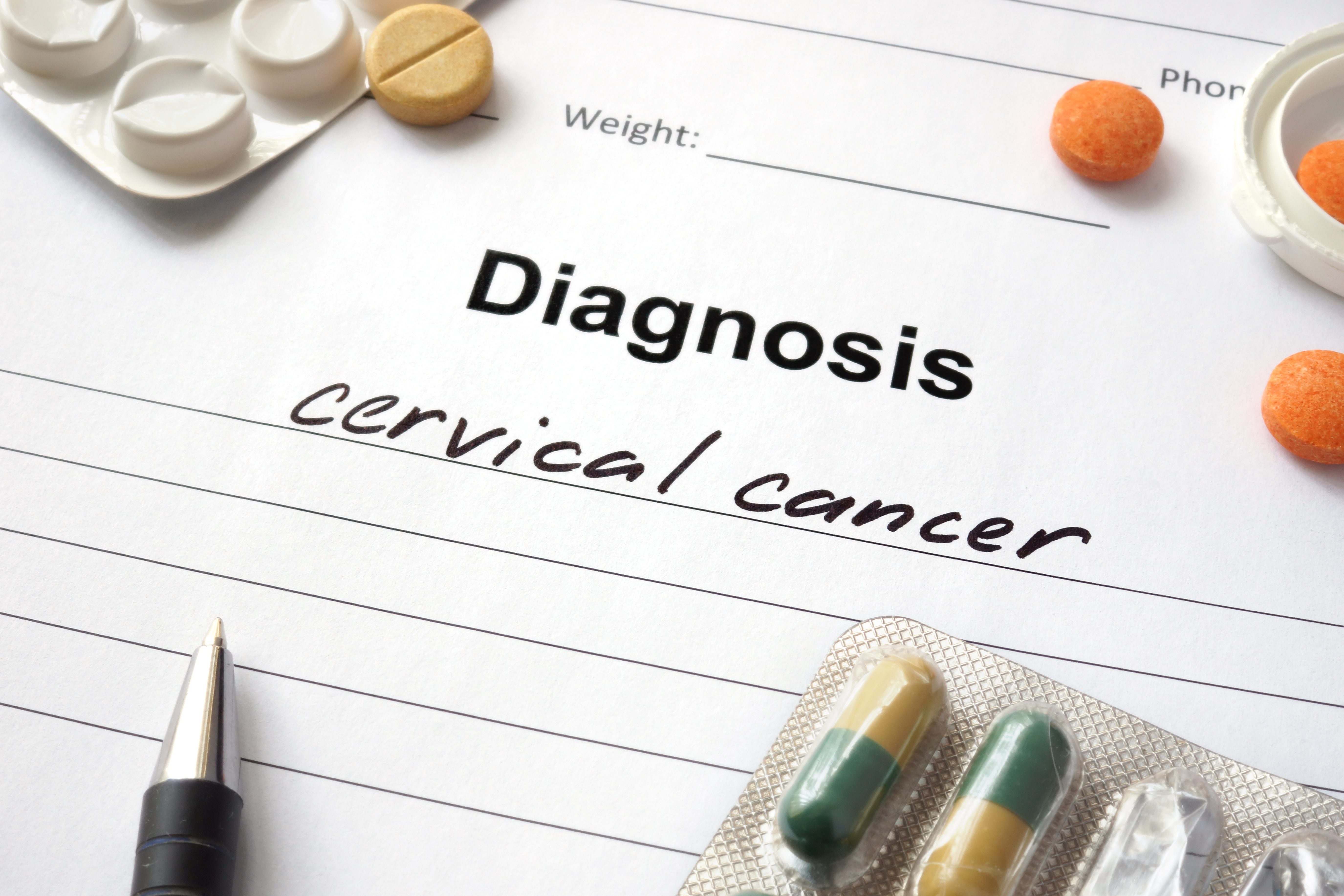 Cancerwise博客文章：了解宫颈癌的神话